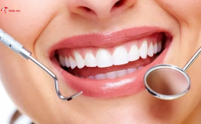 Ưu Và Nhược Điểm Của Răng Sứ LISI