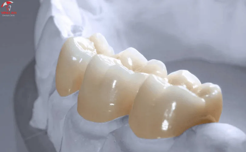 răng sứ lava plus