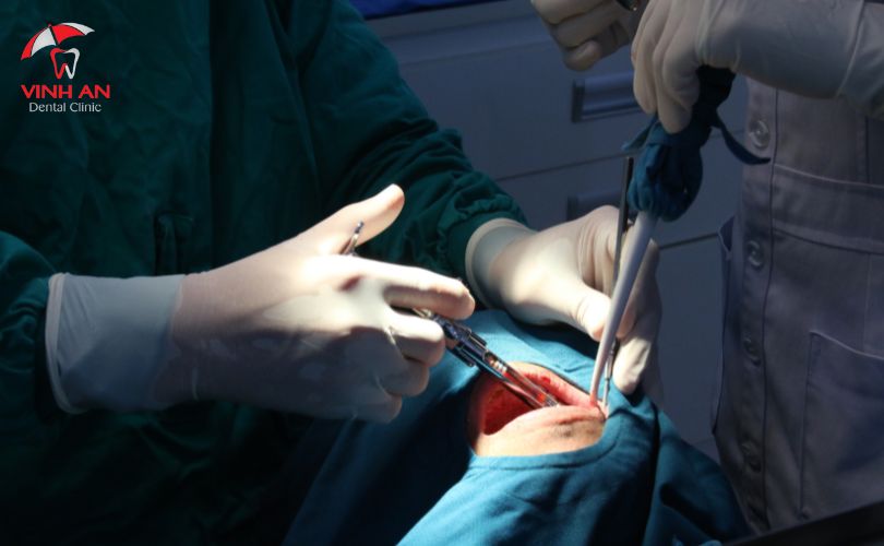 Trồng Răng Implant Cho Người Cao Tuổi Có Được Không? Những Lưu Ý Cần Biết