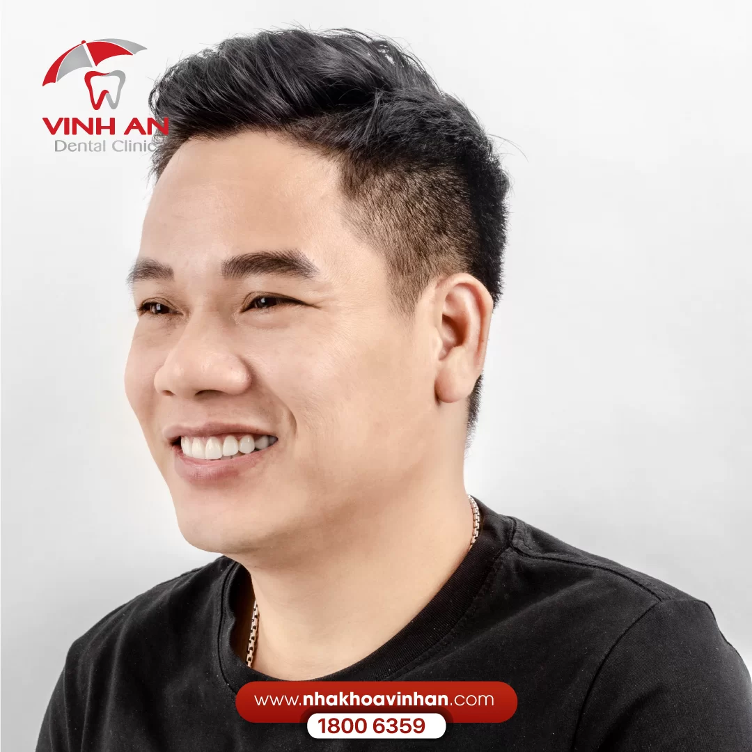 Bọc Sứ Răng Kim Loại