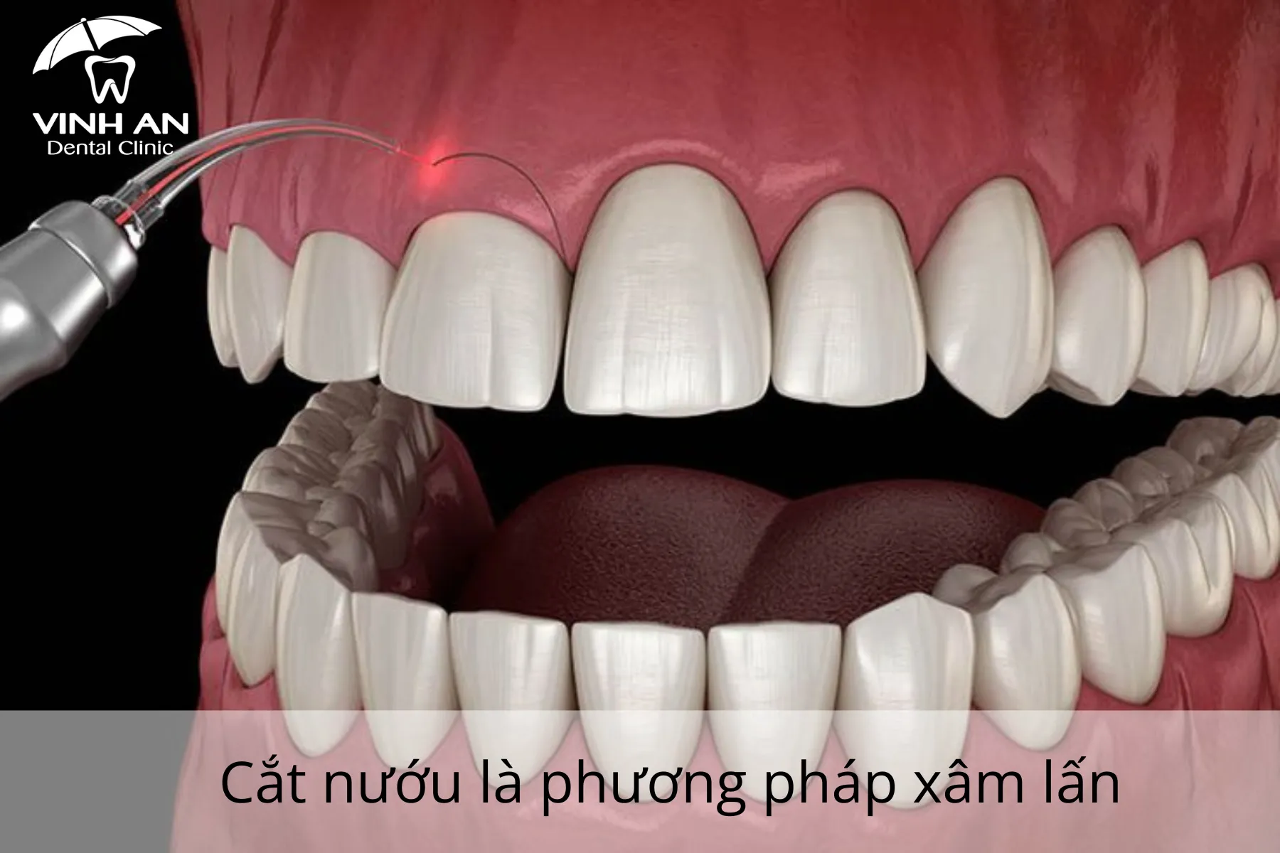 Dieu-tri-cuoi-ho-loi-an-toan (10)