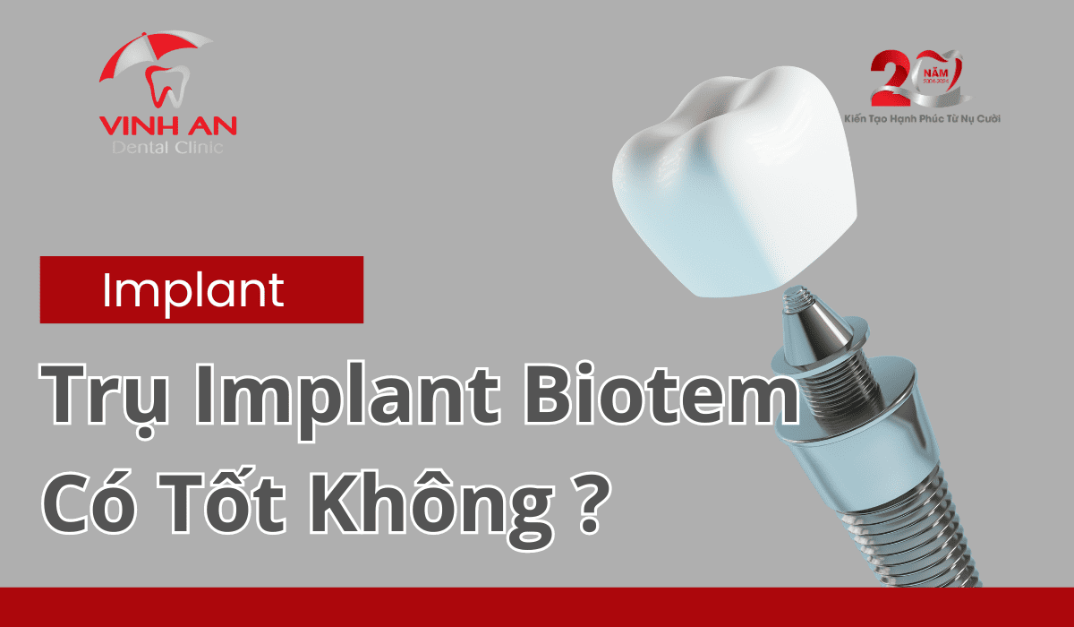 Implant Boitem