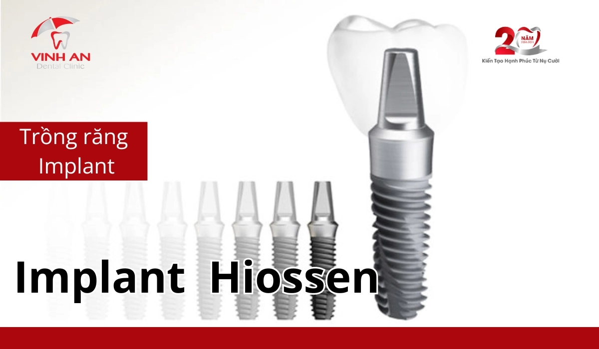 Implant-hiossen