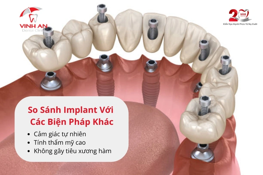 Rang-gia-tren-implant_3