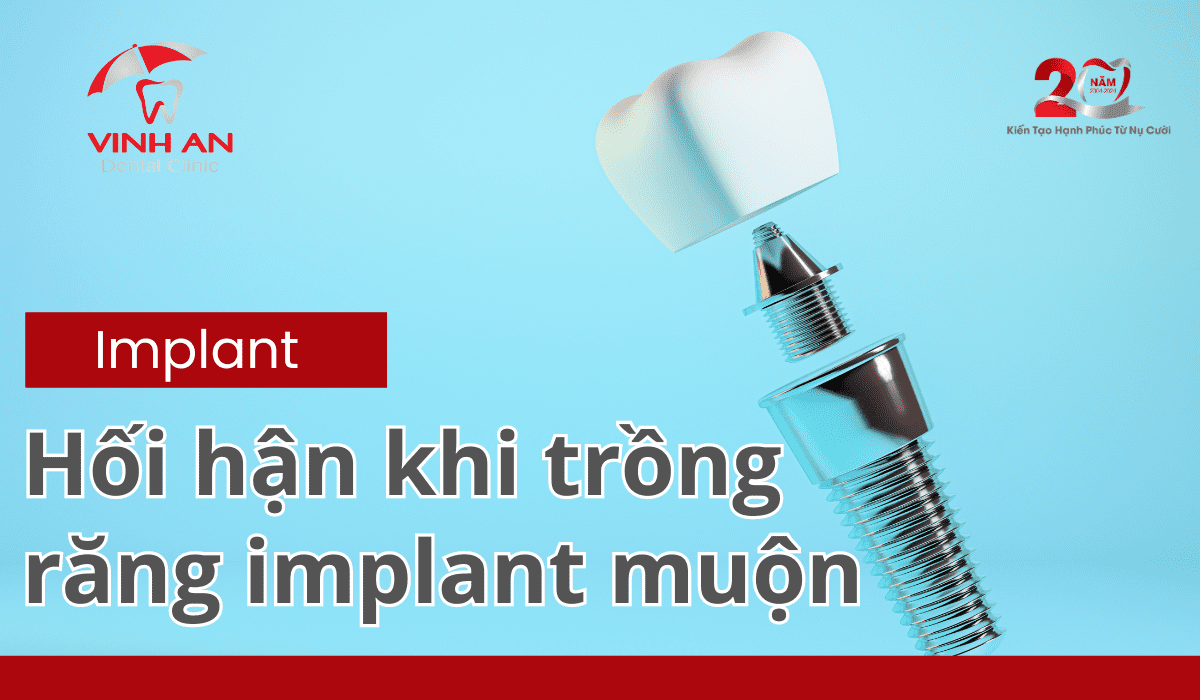 Hối-hận-khi-trồng-răng-implant