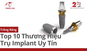 Top 10 Thương Hiệu Trụ Implant Uy Tín