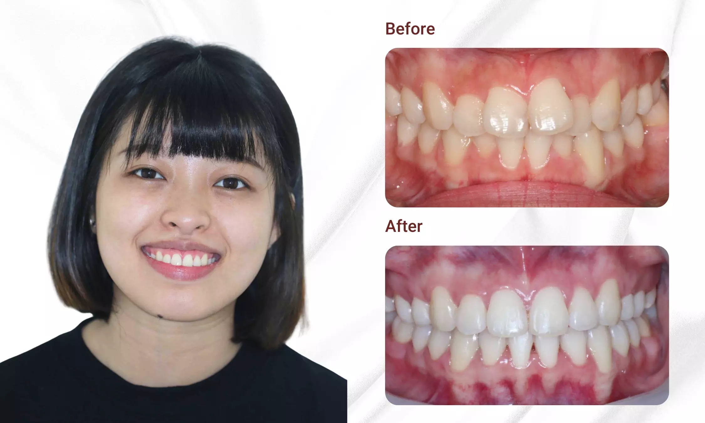 Customer Orthodontic