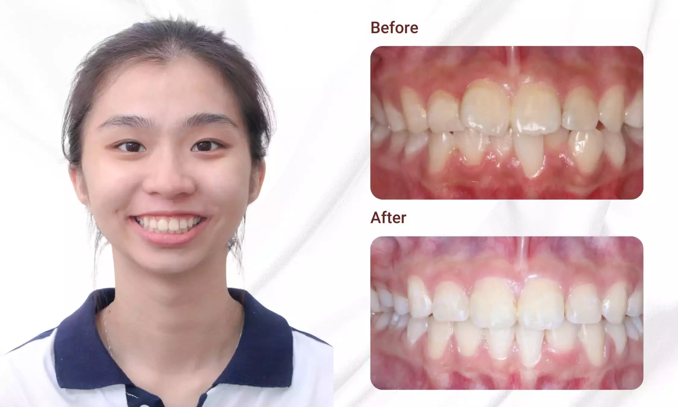 Customer Orthodontic