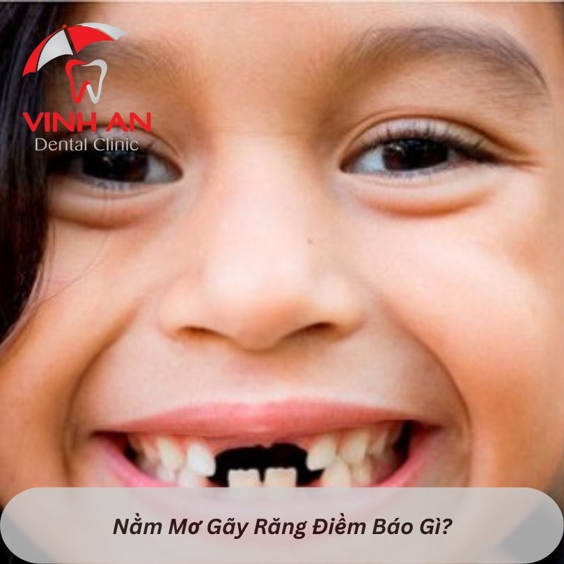 3. Ý nghĩa tâm linh của giấc mơ rụng răng sâu