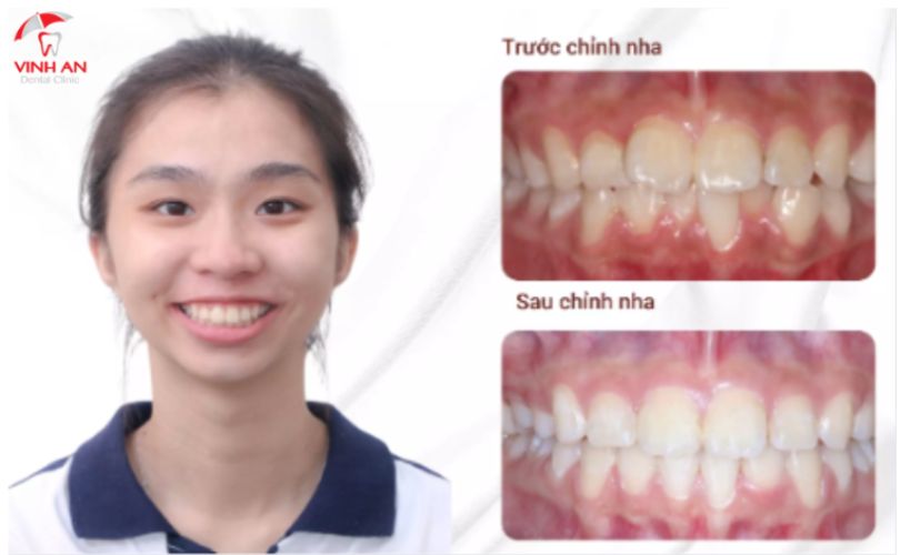 Hình Ảnh Và Review Của Khách Hàng