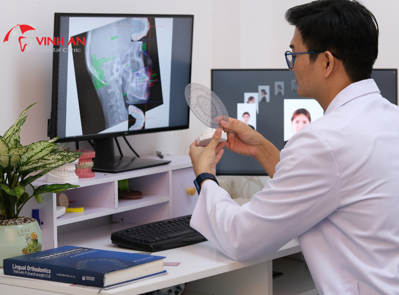 20 tuổi niềng răng khoảng bao nhiêu tiền