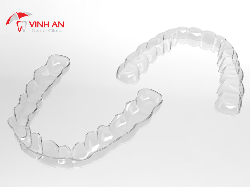 20 Tuổi Niềng Răng Bao Nhiêu Tiền? Niềng Răng Trong Suốt