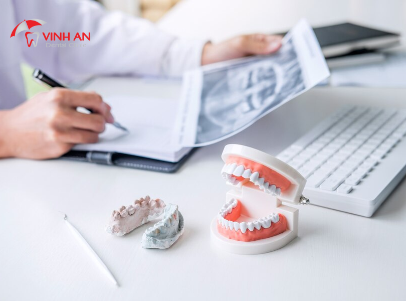 20 tuổi niềng răng khoảng bao nhiêu tiền