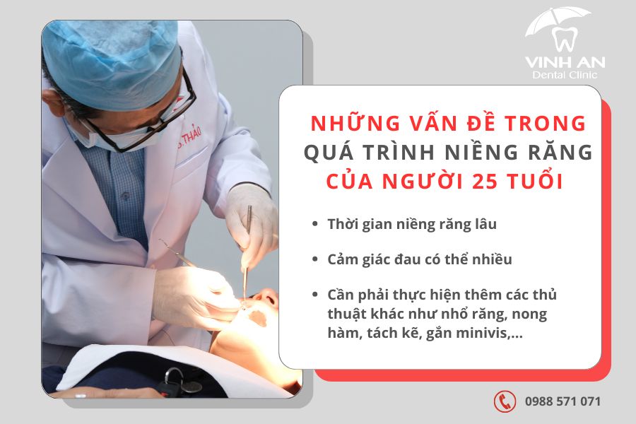 25 Tuổi Niềng Răng Được Không 