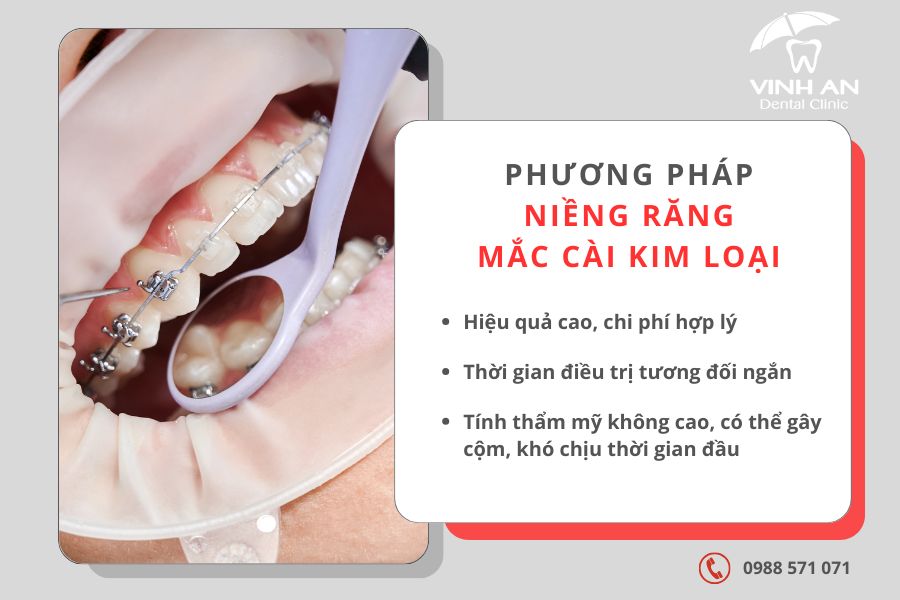 25 Tuổi Niềng Răng Được Không 