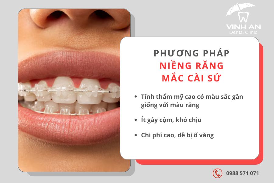 25 Tuổi Niềng Răng Được Không 