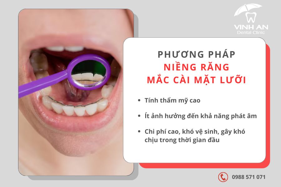 25 Tuổi Niềng Răng Được Không 