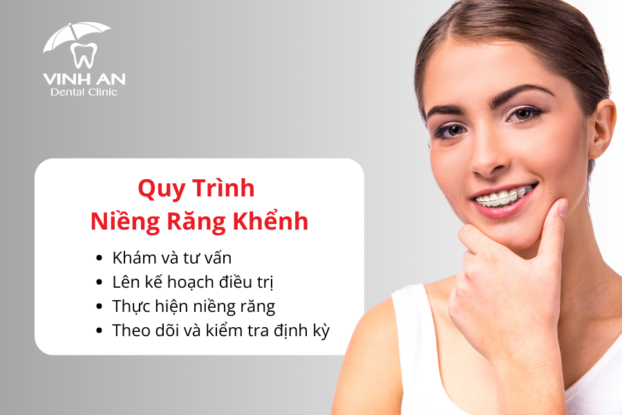 Quy trình niềng răng khểnh