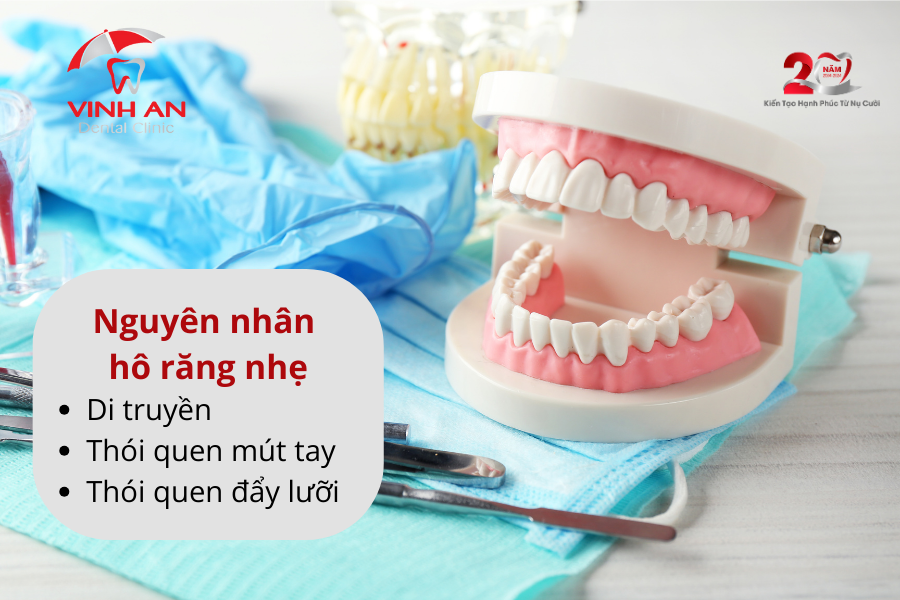 Chữa Răng Hô Nhẹ Không Cần Niềng