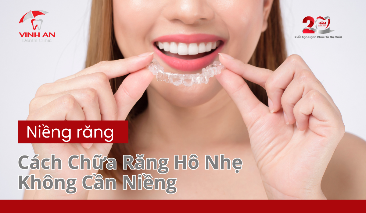 Chữa Răng Hô Nhẹ Không Cần Niềng