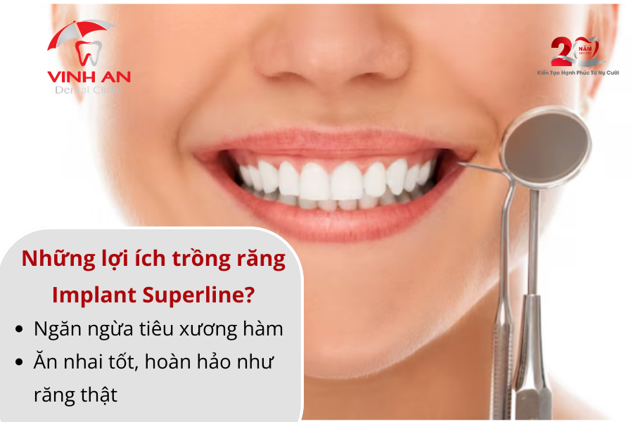 Implant Superline 2