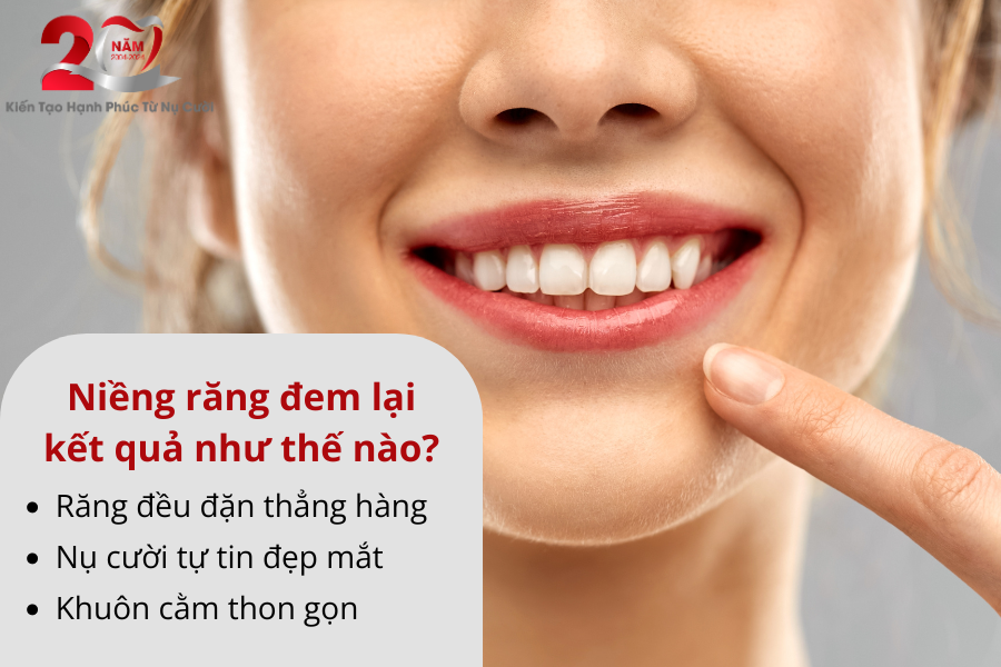 Kq Niềng Răng 1