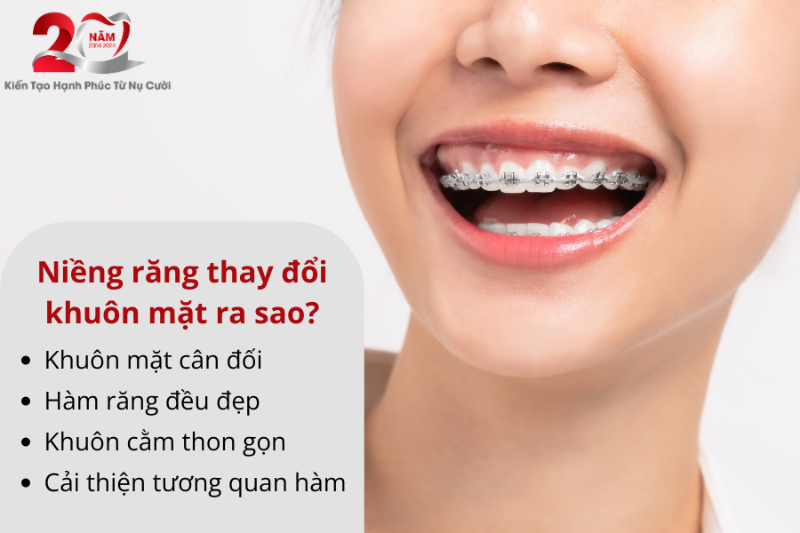 Kq Niềng Răng 2