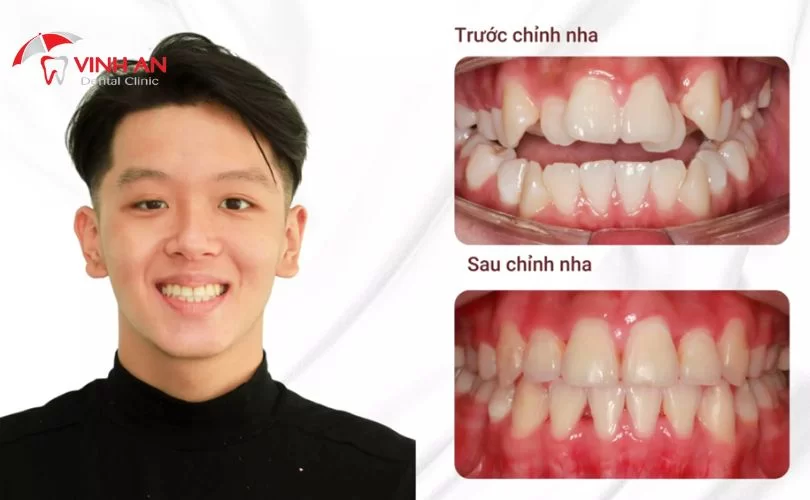 Nha-khoa-uy-tin-sai-gon-2