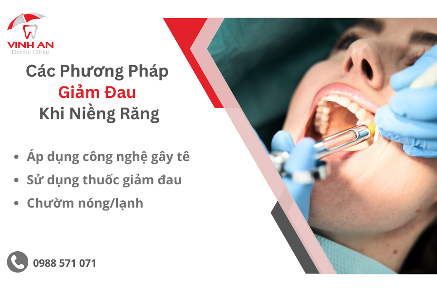 Niềng Răng Cửa Thưa Mất Bao Nhiêu Tiền 4