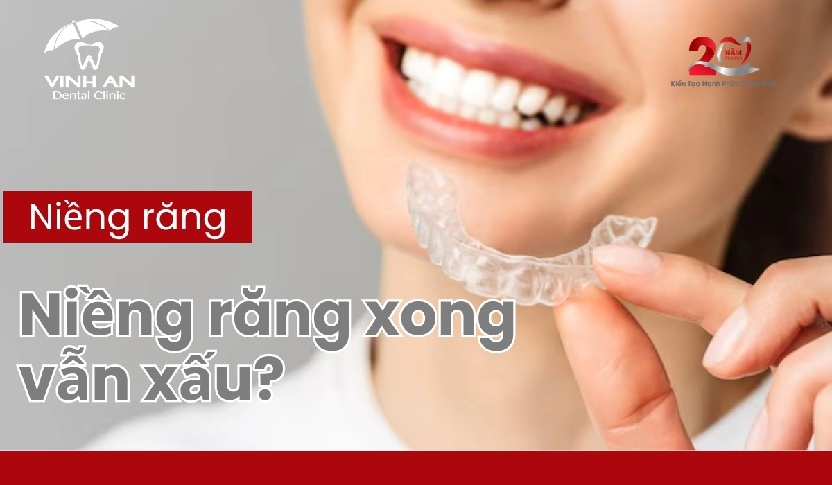 Niềng Răng Xong Vẫn Xấu - Thumnail