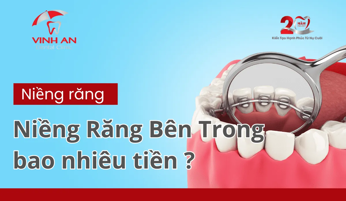 Niềng Răng Bên Trong (1)_1