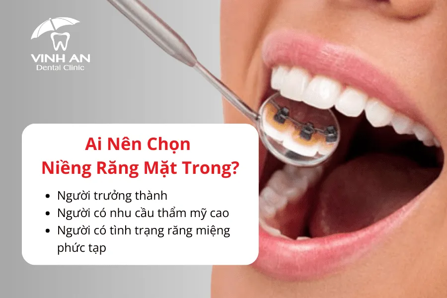 Niềng Răng Bên Trong 2_3