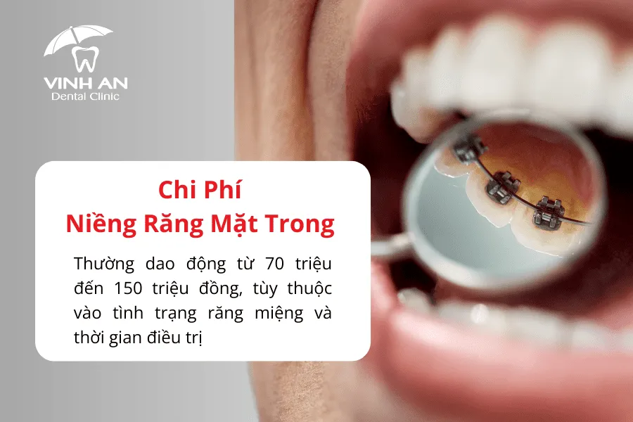 Niềng Răng Bên Trong 4_5