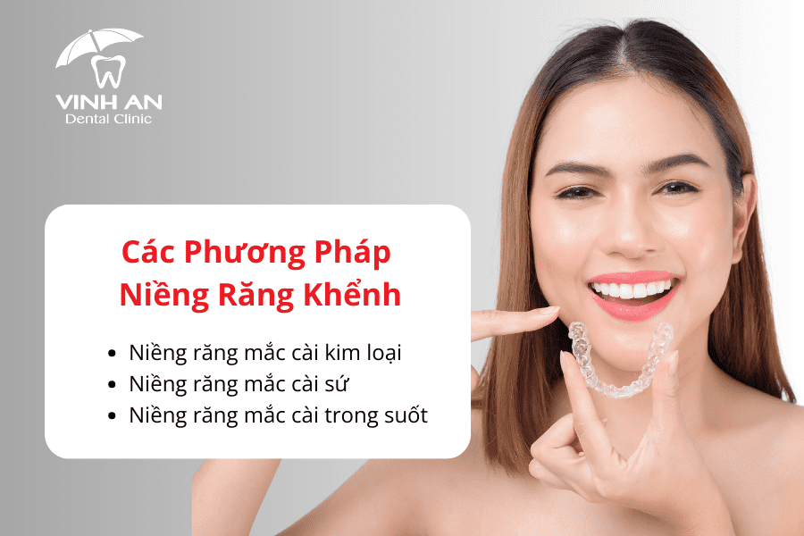 Niềng-răng-khểnh-_4_