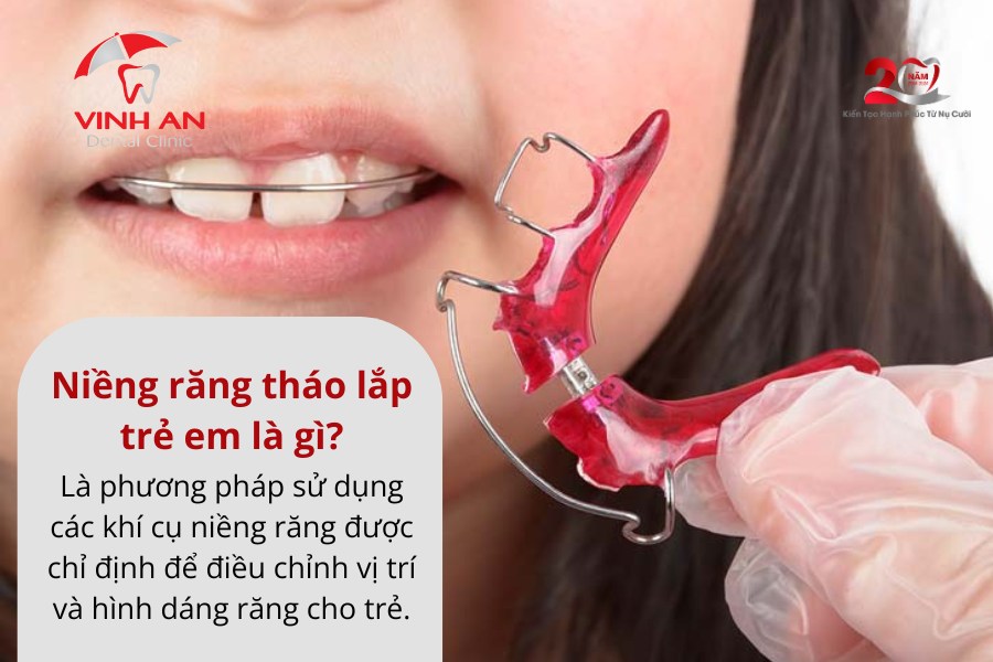 Niềng Răng Tháo Lắp Trẻ Em Là Gì