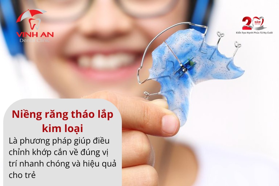 Niềng Răng Tháo Lắp Trẻ Em Là Gì