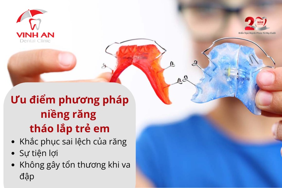 Niềng Răng Tháo Lắp Trẻ Em Là Gì