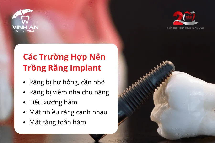 Sau Khi Nhổ Răng Bao Lâu Thì Trồng Implant2