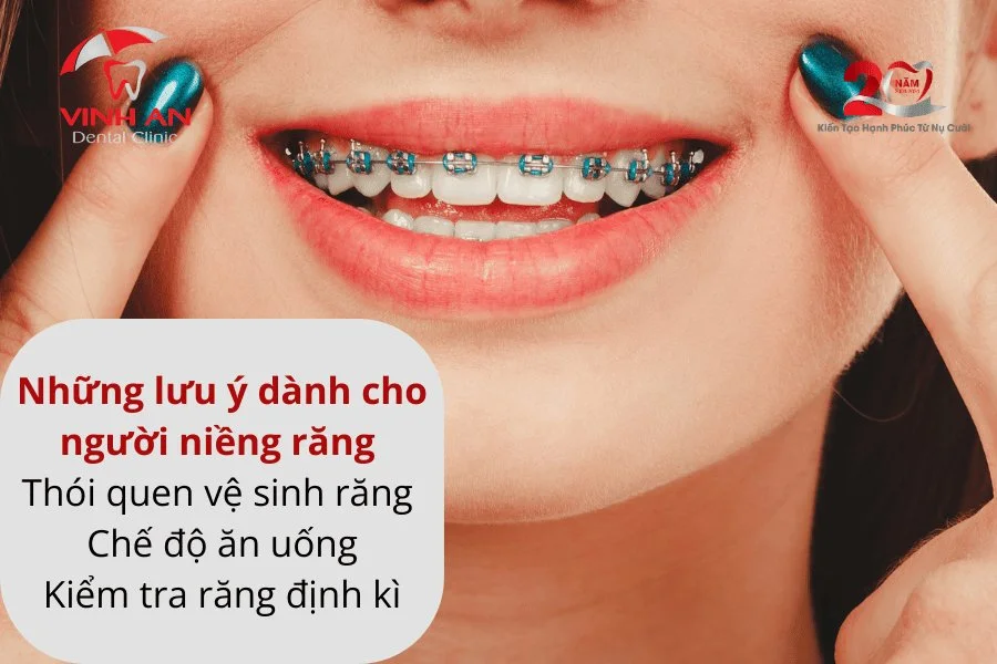 Vệ sinh răng niềng.
