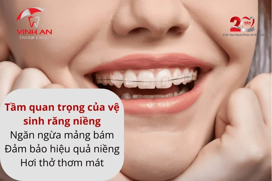 Vệ sinh răng niềng.