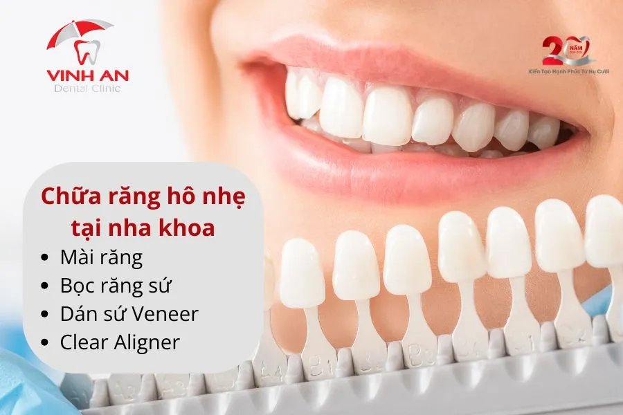 Chua-rang-ho-nhe-khong-can-nieng 2