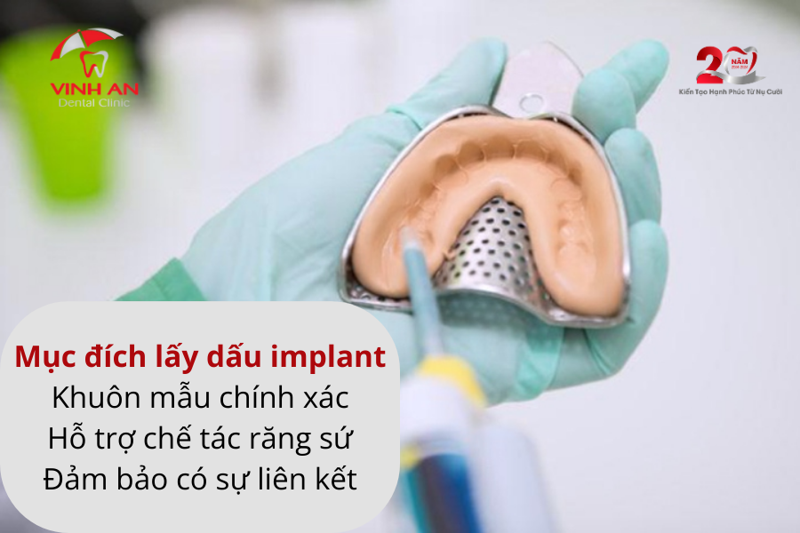 Lấy Dấu Implant