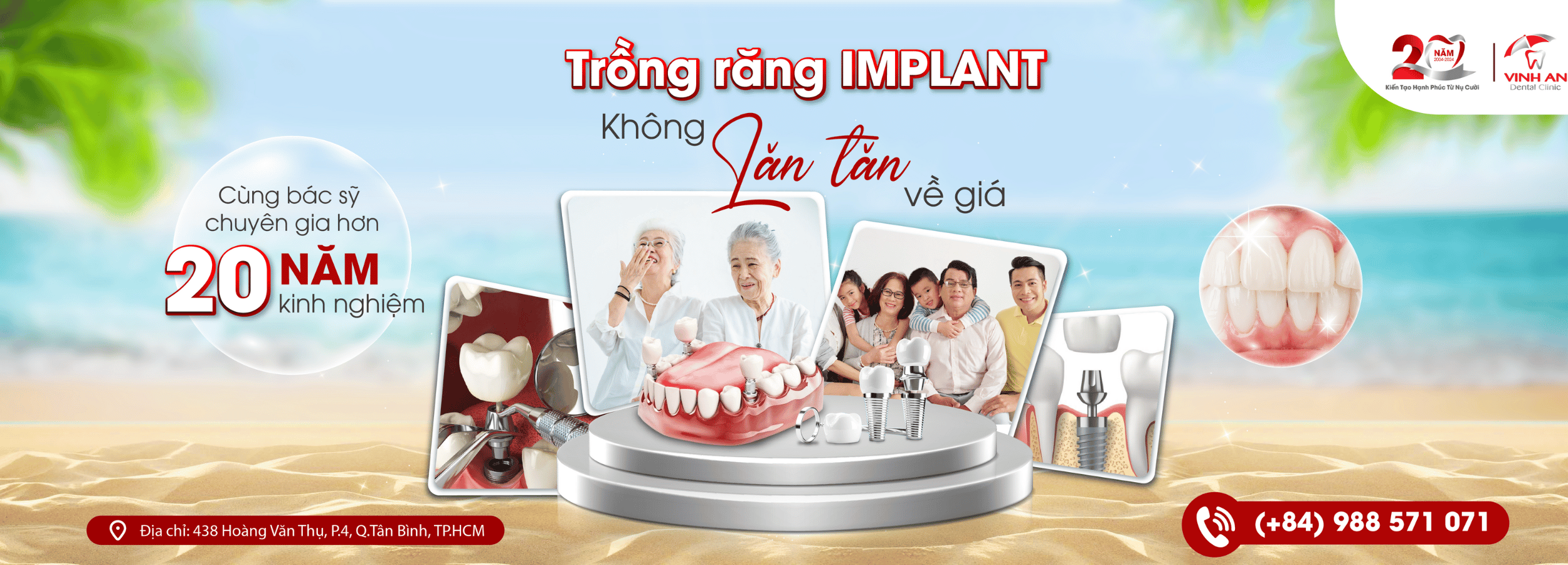 Implant-banner