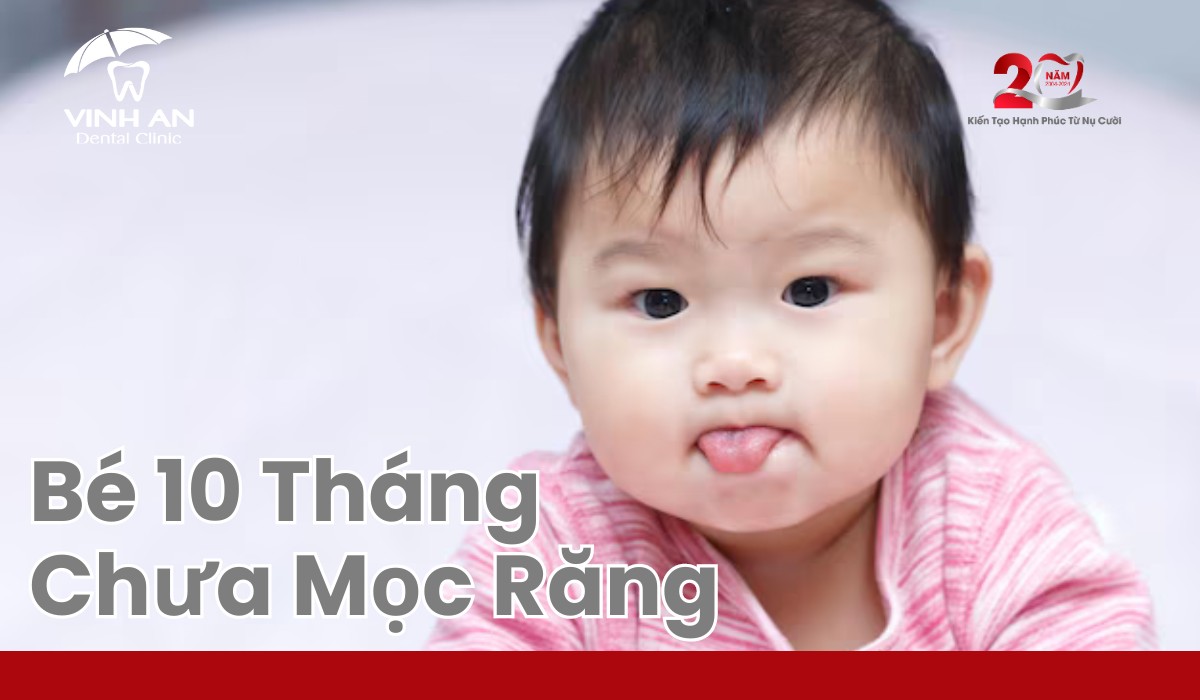 Bé 10 Tháng Chưa Mọc Răng - Thumbnail