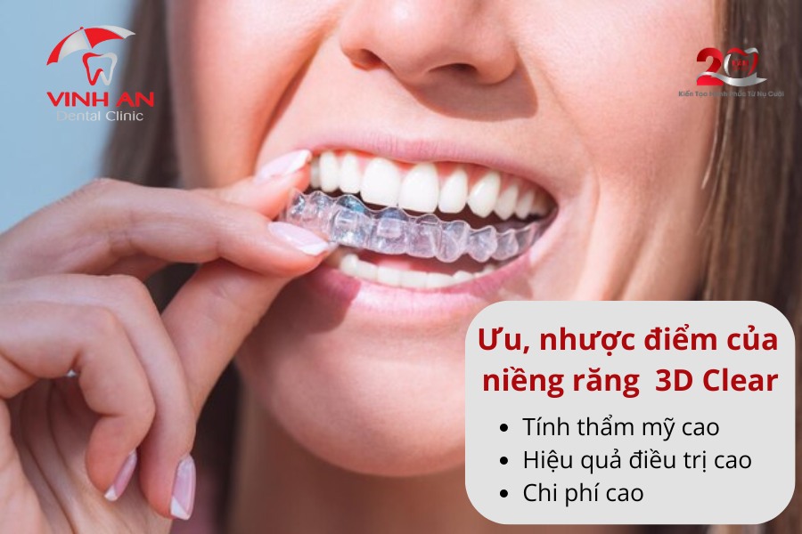 Niềng Răng 3d Clear Là Gì 2