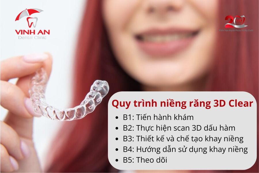 Niềng Răng 3d Clear Là Gì 3