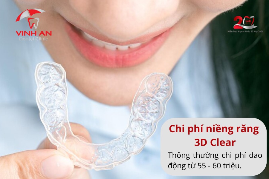 Niềng Răng 3d Clear Là Gì 4