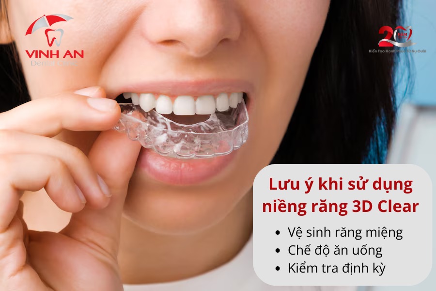 Niềng Răng 3d Clear Là Gì 5