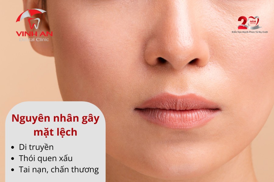 Niềng Răng Có Hết Lệch Mặt Không