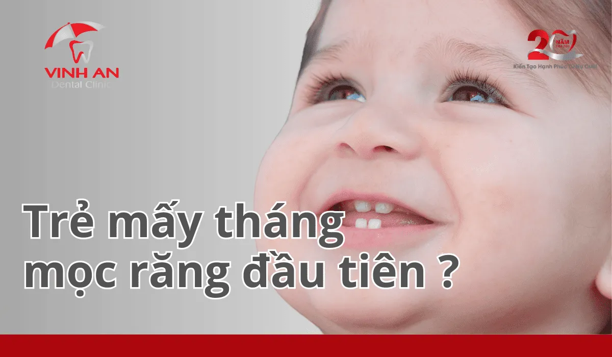 Trẻ Mấy Tháng Mọc Răng (1)_1